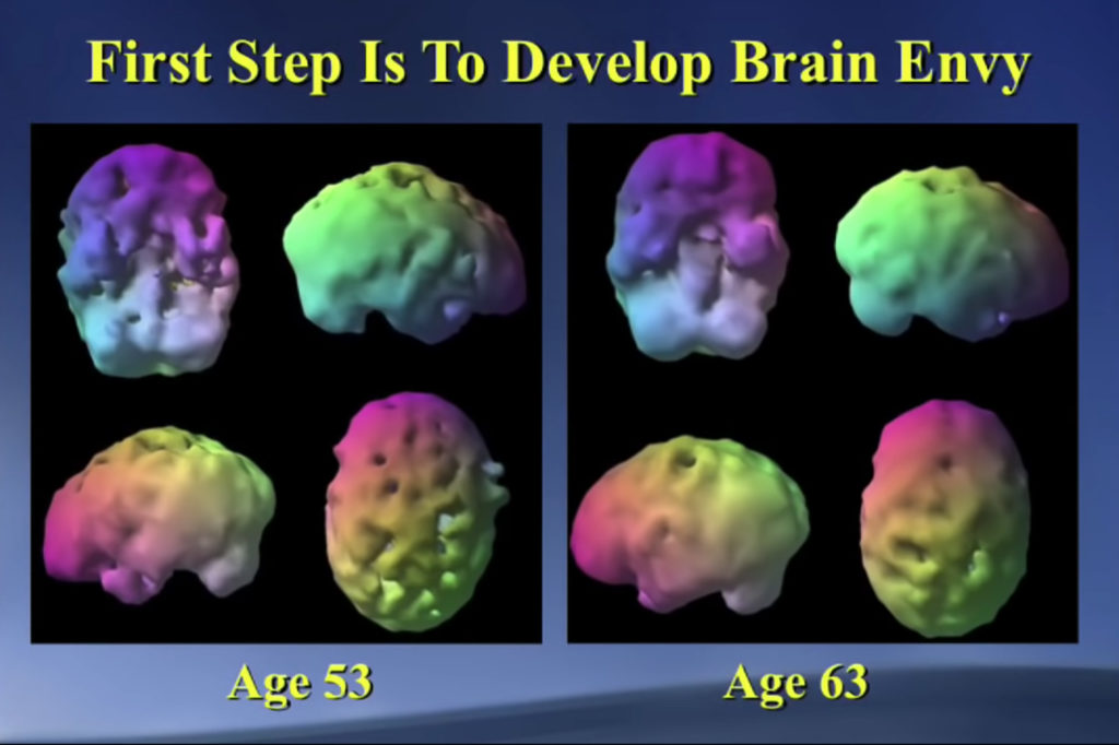 Как омолодить мозг в любом возрасте. Выступление нейробиолога