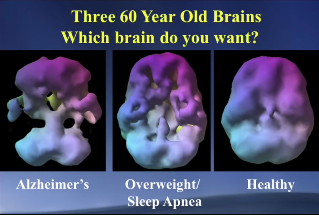 Как омолодить мозг в любом возрасте. Выступление нейробиолога