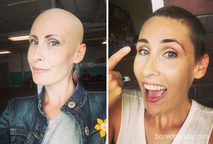Победили рак сами. Люди до и после химиотерапии. Люди после химиотерапии до и после. Фото до и после химиотерапии. Волосы до и после химиотерапии.