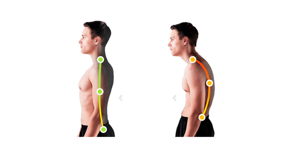 Правильная осанка у мужчин фото сбоку