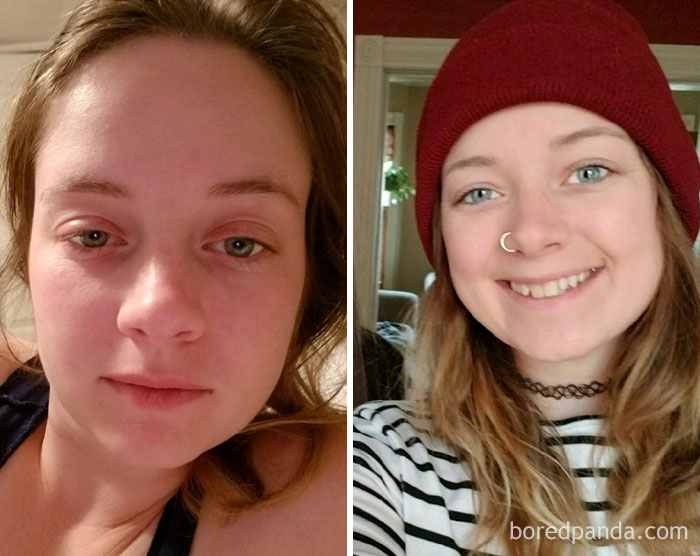 Лицо пьющей женщины фото до и после