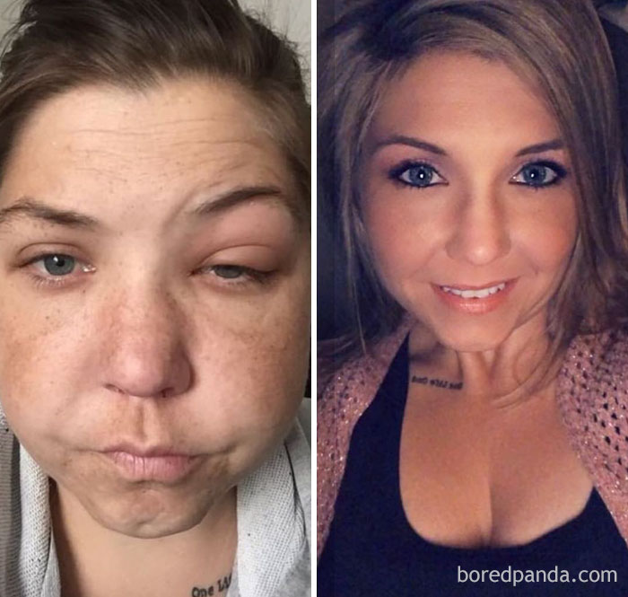 Лицо пьющей женщины фото до и после